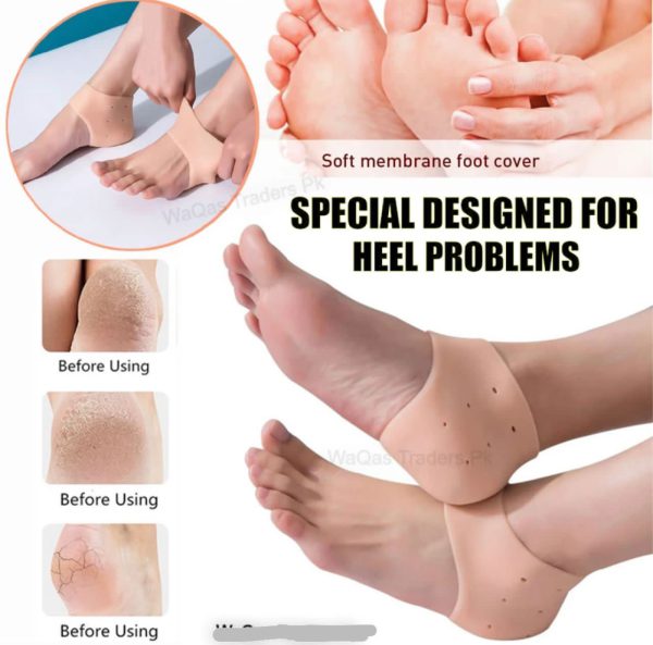 Half Heel Pain Anti Crack Silicone Set Anti Crack For Pain Relief