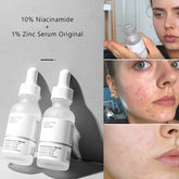 Ordinary Niacinamide 10% + Zinc 1%