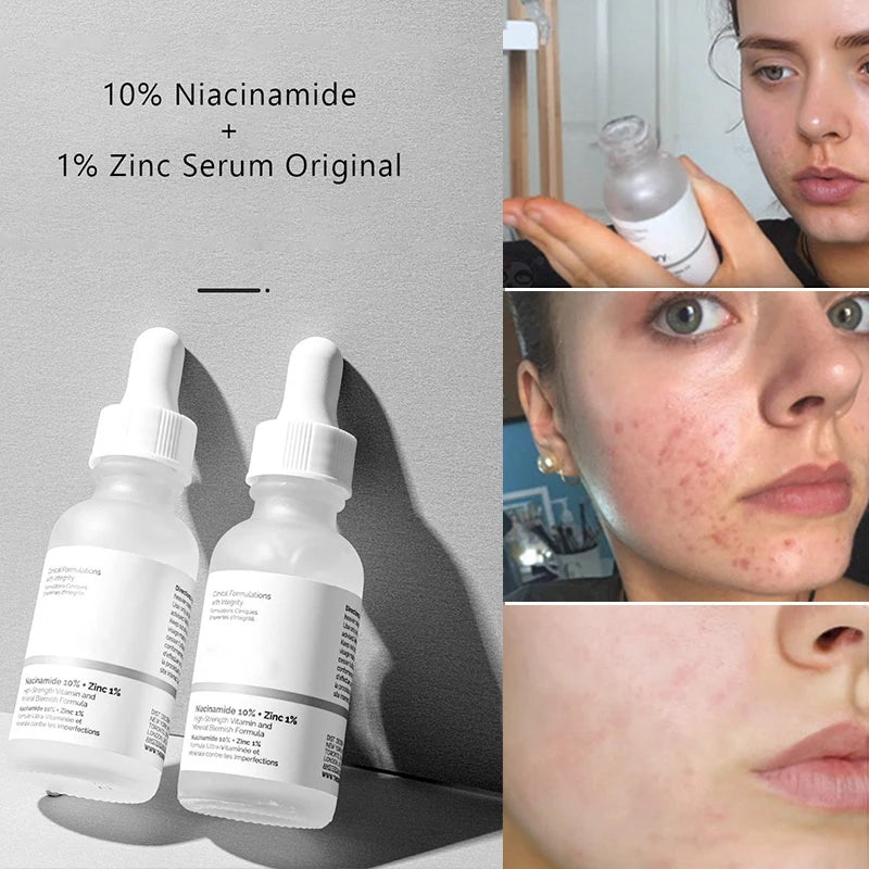Ordinary Niacinamide 10% + Zinc 1%